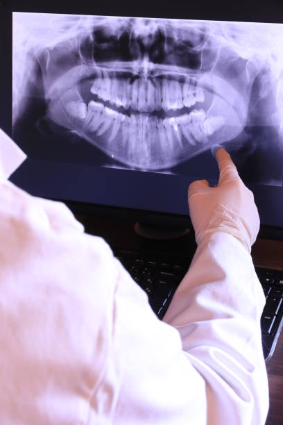 Best Emergency Treatment for Oral Infections in South Milwaukee, WI
